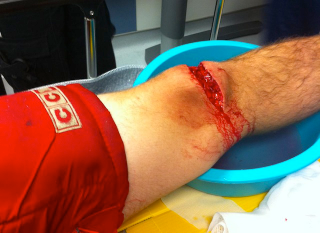 Illustration for article titled These Gruesome Hockey Injuries Are Very Bad; Hockey Is Bad
